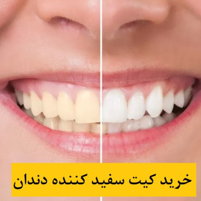 کیت سفید کننده دندان + راهنمای خرید